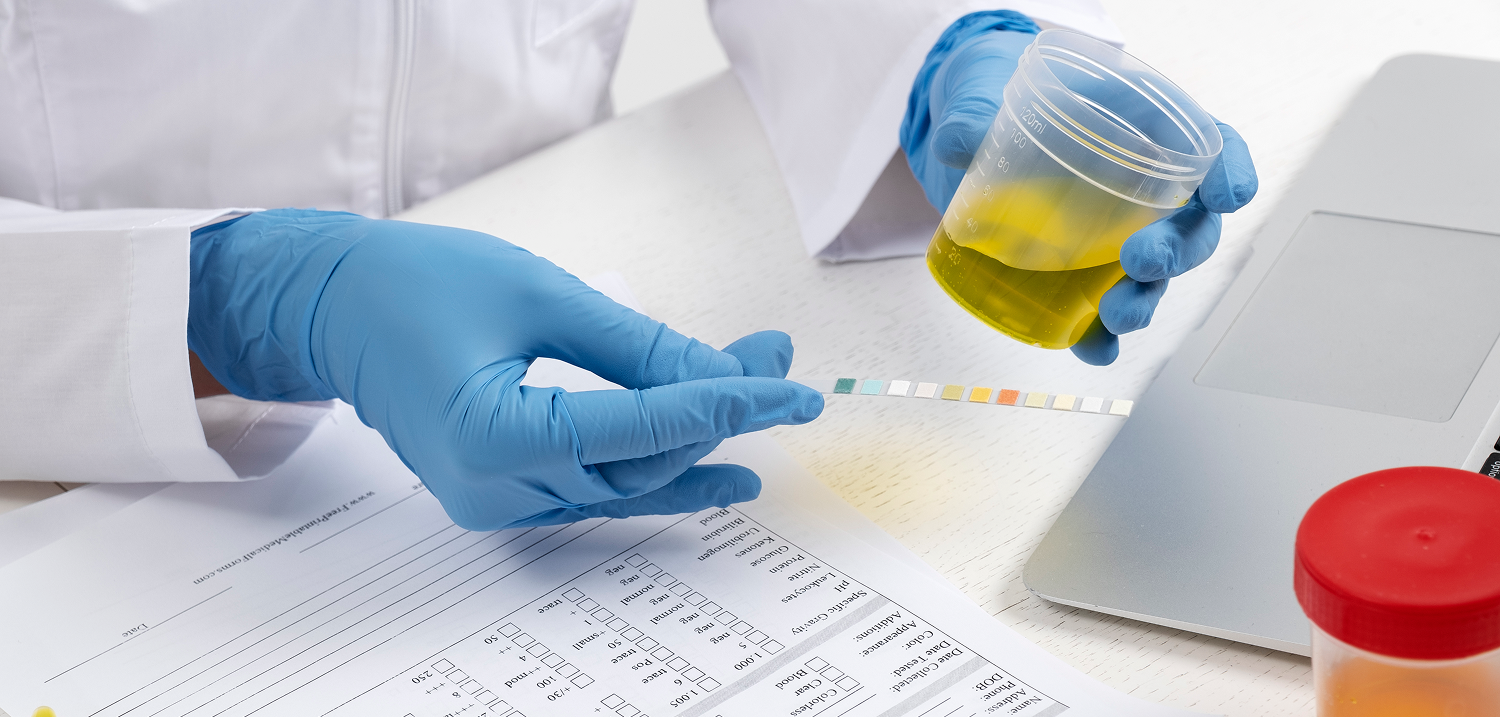 Exames Toxicológicos